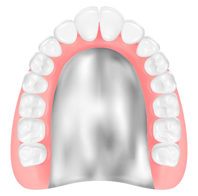 金属床入れ歯